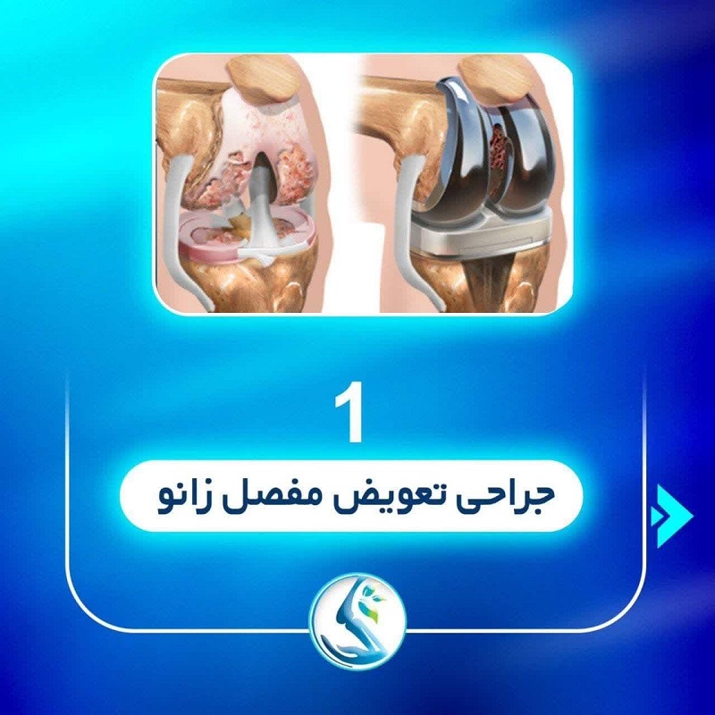 بهترین تعویض مفصل زانو اصفهان | دکتر سینا طالبی | بهترین جراح زانو اصفهان | بهترین جراح رباط صلیبی اصفهان | بهترین تعویض مفصل زانو اصفهان