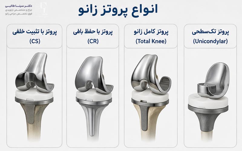 انواع پروتز زانو کدام‌اند؟