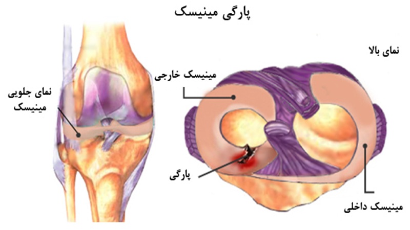 دکتر سینا طالبی | بهترین جراح زانو اصفهان | بهترین جراح رباط صلیبی اصفهان | بهترین تعویض مفصل زانو اصفهان