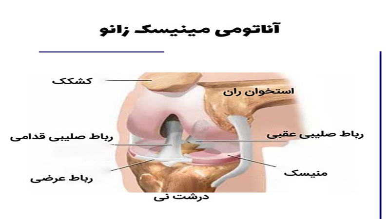 احتمال عود مینیسک |دکتر سینا طالبی | بهترین جراح زانو اصفهان | بهترین جراح رباط صلیبی اصفهان | بهترین تعویض مفصل زانو اصفهان