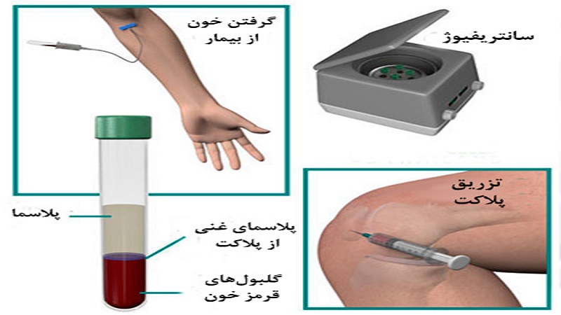 دکتر سینا طالبی | بهترین جراح زانو اصفهان | بهترین جراح رباط صلیبی اصفهان | بهترین تعویض مفصل زانو اصفهان