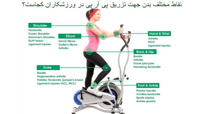 مقایسه PRP با سایر درمان ها |دکتر سینا طالبی | بهترین جراح زانو اصفهان | بهترین جراح رباط صلیبی اصفهان | بهترین تعویض مفصل زانو اصفهان