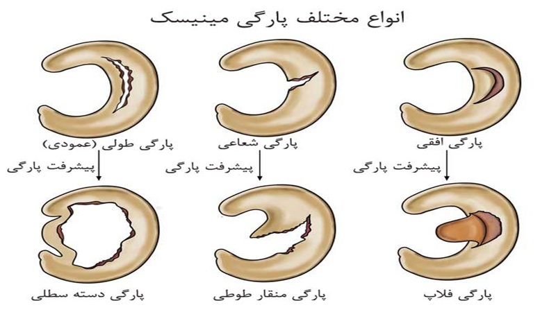 دکتر سینا طالبی | بهترین جراح زانو اصفهان | بهترین جراح رباط صلیبی اصفهان | بهترین تعویض مفصل زانو اصفهان
