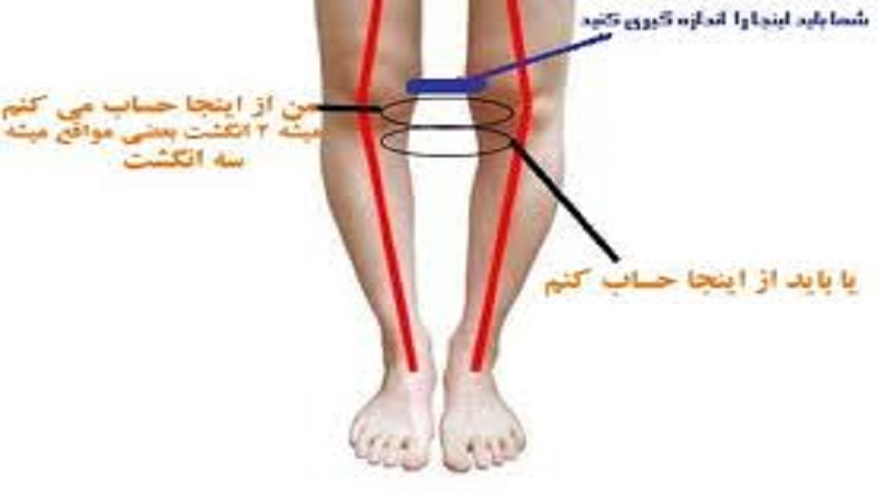 دکتر سینا طالبی | بهترین جراح زانو اصفهان | بهترین جراح رباط صلیبی اصفهان | بهترین تعویض مفصل زانو اصفهان