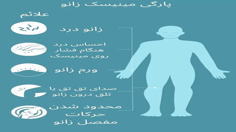 روش تشخیص آسیب مینیسک زانو |دکتر سینا طالبی | بهترین جراح زانو اصفهان | بهترین جراح رباط صلیبی اصفهان | بهترین تعویض مفصل زانو اصفهان