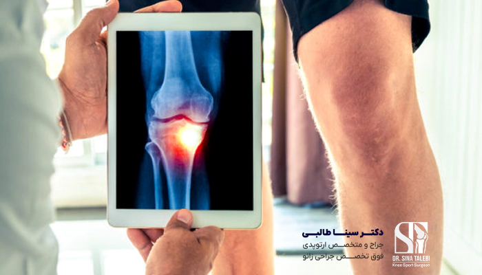 ویژگی‌ های بهترین دکتر آرتروز زانو در تهران