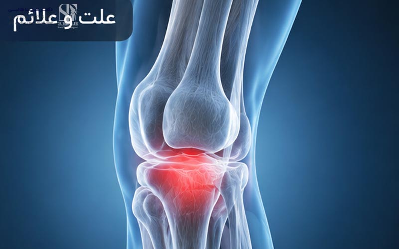 درد زیر زانو هنگام راه رفتن چه علتی دارد؟