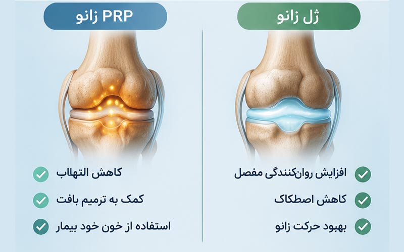 PRP بهتر است یا ژل زانو؟