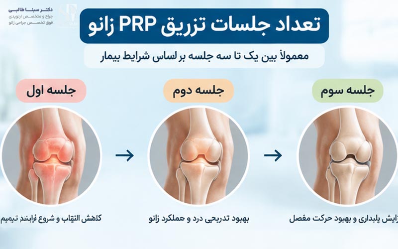 تعداد جلسات تزریق PRP زانو
