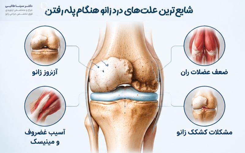 شایع‌ترین علت‌های درد زانو هنگام پله رفتن