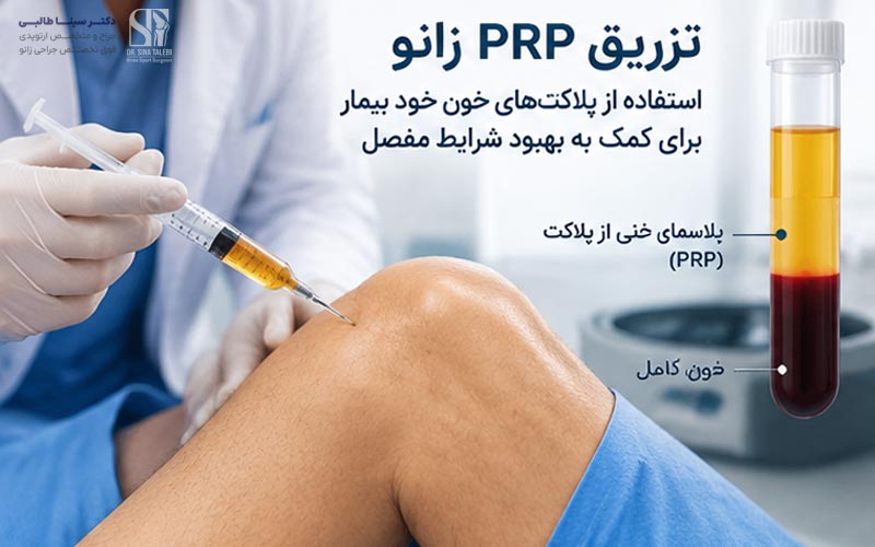 چه کسانی کاندید مناسب PRP یا ژل زانو هستند؟
